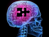 alzheimers-brainpuzzle-512